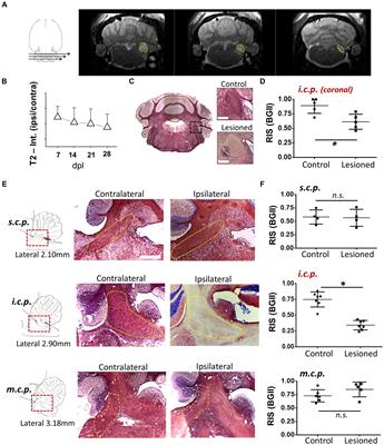 β-carbolines that enhance GABAA receptor response expressed in oligodendrocytes promote remyelination in an in vivo rat model of focal demyelination